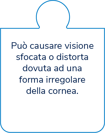 Astigmatismo